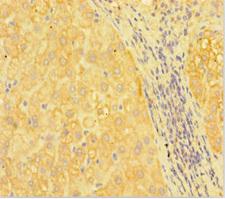 RANBP1 Antibody - Immunohistochemistry of paraffin-embedded human liver tissue at dilution 1:100