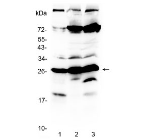 RANBP1 Antibody - Western blot testing of human 1) MCF7, 2) HeLa and 3) HepG2 lysate with RanBP1 antibody at 0.5ug/ml. Expected molecular weight 23-26 kDa.