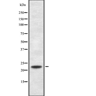 RANBP1 Antibody - Western blot analysis of RANBP1 using MCF-7 whole cells lysates