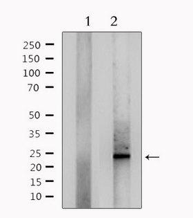 RANBP1 Antibody - Western blot analysis of extracts of mouse lung using RANBP1 antibody. Lane 1 was treated with the antigen-specific peptide.