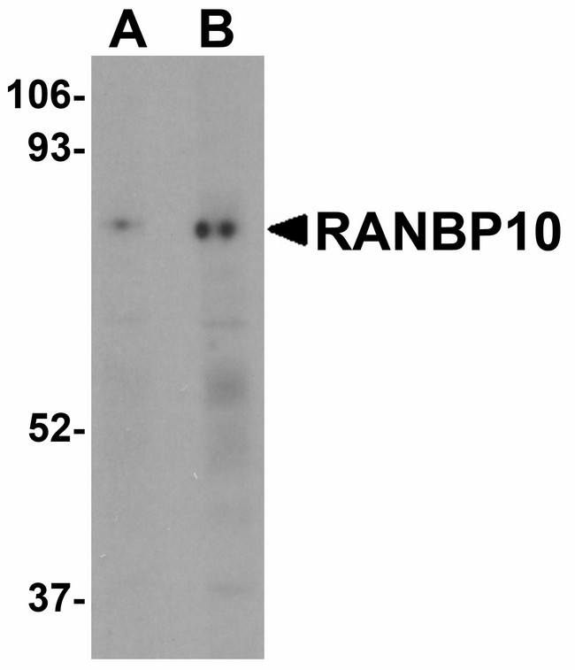 RANBP10 Antibody - Western blot of RANBP10 in human skeletal muscle tissue lysate with RANBP10 antibody at (A) 1 and (B) 2 ug/ml.