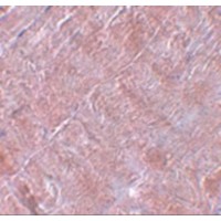 RANBP10 Antibody - Immunohistochemistry of RANBP10 in human skeletal muscle tissue with RANBP10 antibody at 5 µg/mL.