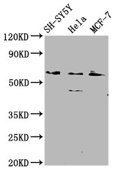 RANBP10 Antibody - Western Blot Positive WB detected in: SH-SY5Y whole cell lysate, Hela whole cell lysate, MCF-7 whole cell lysate All Lanes: RANBP10 antibody at 2.1µg/ml Secondary Goat polyclonal to rabbit IgG at 1/50000 dilution Predicted band size: 68, 59, 65 KDa Observed band size: 68 KDa