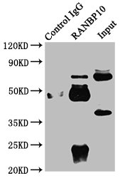 RANBP10 Antibody - Immunoprecipitating RANBP10 in Rat Brain tissue Lane 1: Rabbit control IgG instead of RANBP10 Antibody in Rat Brain tissue.For western blotting, a HRP-conjugated Protein G antibody was used as the secondary antibody (1/2000) Lane 2: RANBP10 Antibody (6µg) + Rat Brain tissue (1mg) Lane 3: Rat Brain tissue (20µg)