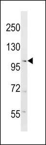 RANBP17 Antibody - RANBP17 Antibody western blot of mouse testis tissue lysates (35 ug/lane). The RANBP17 antibody detected the RANBP17 protein (arrow).