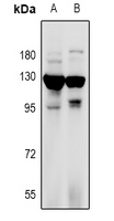 RANBP17 Antibody - Western blot analysis of RANBP17 expression in rat testis (A), mouse testis (B) whole cell lysates.