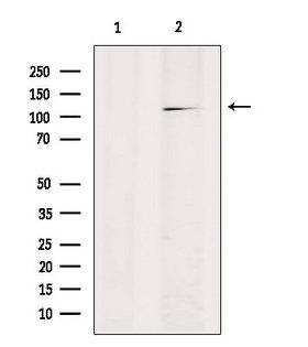 RANBP17 Antibody - Western blot analysis of extracts of HepG2 cells using RANBP17 antibody. Lane 1 was treated with the blocking peptide.