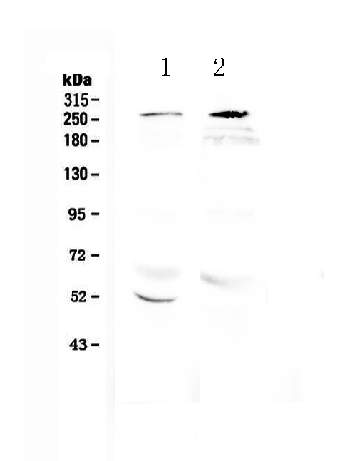 RANBP2 / TRP1 Antibody - Western blot analysis of RanBP2 using anti-RanBP2 antibody. Electrophoresis was performed on a 5-20% SDS-PAGE gel at 70V (Stacking gel) / 90V (Resolving gel) for 2-3 hours. The sample well of each lane was loaded with 50ug of sample under reducing conditions. Lane 1: rat brain tissue lysate,Lane 2: mouse brain tissue lysate. After Electrophoresis, proteins were transferred to a Nitrocellulose membrane at 150mA for 50-90 minutes. Blocked the membrane with 5% Non-fat Milk/ TBS for 1.5 hour at RT. The membrane was incubated with rabbit anti-RanBP2 antigen affinity purified polyclonal antibody at 0.5 µg/mL overnight at 4°C, then washed with TBS-0.1% Tween 3 times with 5 minutes each and probed with a goat anti-rabbit IgG-HRP secondary antibody at a dilution of 1:10000 for 1.5 hour at RT. The signal is developed using an Enhanced Chemiluminescent detection (ECL) kit with Tanon 5200 system. A specific band was detected for RanBP2 at approximately 270KD. The expected band size for RanBP2 is at 358KD.