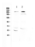 RANBP2 / TRP1 Antibody - Western blot analysis of RanBP2 using anti-RanBP2 antibody. Electrophoresis was performed on a 5-20% SDS-PAGE gel at 70V (Stacking gel) / 90V (Resolving gel) for 2-3 hours. The sample well of each lane was loaded with 50ug of sample under reducing conditions. Lane 1: rat brain tissue lysate,Lane 2: mouse brain tissue lysate. After Electrophoresis, proteins were transferred to a Nitrocellulose membrane at 150mA for 50-90 minutes. Blocked the membrane with 5% Non-fat Milk/ TBS for 1.5 hour at RT. The membrane was incubated with rabbit anti-RanBP2 antigen affinity purified polyclonal antibody at 0.5 µg/mL overnight at 4°C, then washed with TBS-0.1% Tween 3 times with 5 minutes each and probed with a goat anti-rabbit IgG-HRP secondary antibody at a dilution of 1:10000 for 1.5 hour at RT. The signal is developed using an Enhanced Chemiluminescent detection (ECL) kit with Tanon 5200 system. A specific band was detected for RanBP2 at approximately 270KD. The expected band size for RanBP2 is at 358KD.