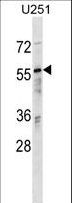 RANBP3 Antibody - RANBP3 Antibody western blot of U251 cell line lysates (35 ug/lane). The RANBP3 antibody detected the RANBP3 protein (arrow).