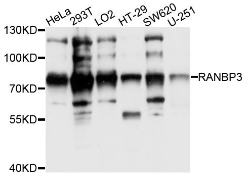RANBP3 Antibody - Western blot analysis of extracts of various cell lines, using RANBP3 antibody at 1:1000 dilution. The secondary antibody used was an HRP Goat Anti-Rabbit IgG (H+L) at 1:10000 dilution. Lysates were loaded 25ug per lane and 3% nonfat dry milk in TBST was used for blocking. An ECL Kit was used for detection and the exposure time was 1s.