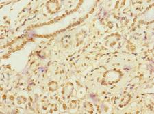RANBP3 Antibody - Immunohistochemistry of paraffin-embedded human pancreatic cancer at dilution 1:100
