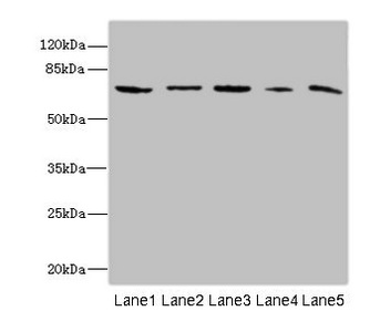 RANBP3 Antibody - Western blot All Lanes: RANBP3 antibody at 6.4ug/ml Lane 1: Mouse brain tissue Lane 2: Hela whole cell lysate Lane 3: HepG-2 whole cell lysate Lane 4: Jurkat whole cell lysate Lane 5: MCF7 whole cell lysate Secondary Goat polyclonal to rabbit IgG at 1/10000 dilution Predicted band size: 61,60,54 kDa Observed band size: 60 kDa