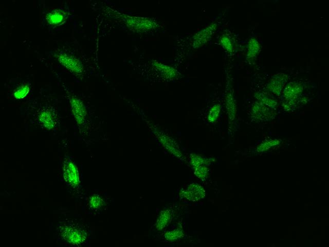 RANBP3 Antibody - Immunofluorescence staining of RANBP3 in U251MG cells. Cells were fixed with 4% PFA, permeabilzed with 0.1% Triton X-100 in PBS, blocked with 10% serum, and incubated with rabbit anti-Human RANBP3 polyclonal antibody (dilution ratio 1:200) at 4°C overnight. Then cells were stained with the Alexa Fluor 488-conjugated Goat Anti-rabbit IgG secondary antibody (green). Positive staining was localized to Nucleus and cytoplasm.