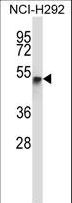 RANBP3L Antibody - RANBP3L Antibody western blot of NCI-H292 cell line lysates (35 ug/lane). The RANBP3L antibody detected the RANBP3L protein (arrow).