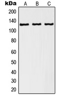 RANBP6 Antibody - Western blot analysis of RANBP6 expression in A549 (A); K562 (B); human kidney (C) whole cell lysates.