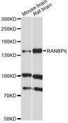 RANBP6 Antibody - Western blot analysis of extracts of various cell lines, using RANBP6 antibody at 1:1000 dilution. The secondary antibody used was an HRP Goat Anti-Rabbit IgG (H+L) at 1:10000 dilution. Lysates were loaded 25ug per lane and 3% nonfat dry milk in TBST was used for blocking. An ECL Kit was used for detection and the exposure time was 30s.