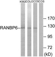 RANBP6 Antibody - Western blot analysis of extracts from K562 cells, COLO cells and COS-7 cells, using RANBP6 antibody.