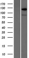 RANBP6 Protein - Western validation with an anti-DDK antibody * L: Control HEK293 lysate R: Over-expression lysate