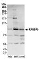 RANBPM Antibody - Detection of human RANBP9 by western blot. Samples: Whole cell lysate (50 µg) from HeLa, HEK293T, and Jurkat cells prepared using NETN lysis buffer. Antibody: Affinity purified rabbit anti-RANBP9 antibody used for WB at 0.1 µg/ml. Detection: Chemiluminescence with an exposure time of 30 seconds.