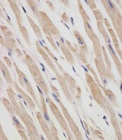RANBPM Antibody - RANBP9 Antibody staining RANBP9 in human heart tissue sections by Immunohistochemistry (IHC-P - paraformaldehyde-fixed, paraffin-embedded sections). Tissue was fixed with formaldehyde and blocked with 3% BSA for 0. 5 hour at room temperature; antigen retrieval was by heat mediation with a citrate buffer (pH6). Samples were incubated with primary antibody (1/25) for 1 hours at 37°C. A undiluted biotinylated goat polyvalent antibody was used as the secondary antibody.