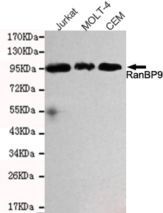 RANBPM Antibody - Western blot detection of RanBP9 in Jurkat, MOLT-4 and CEM cell lysates and using RanBP9 mouse monoclonal antibody (1:1000 dilution). Predicted band size: 78KDa. Observed band size: 95KDa.