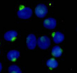 RANBPM Antibody - Immunocytochemistry stain of HeLa using RanBP9 mouse monoclonal antibody (1:300).