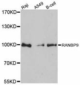 RANBPM Antibody - Western blot analysis of extracts of various cell lines, using RANBP9 antibody at 1:3000 dilution. The secondary antibody used was an HRP Goat Anti-Rabbit IgG (H+L) at 1:10000 dilution. Lysates were loaded 25ug per lane and 3% nonfat dry milk in TBST was used for blocking. An ECL Kit was used for detection and the exposure time was 90s.