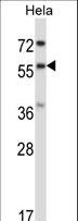 RANGAP1 Antibody - RANGAP1 Antibody western blot of HeLa cell line lysates (35 ug/lane). The RANGAP1 antibody detected the RANGAP1 protein (arrow).