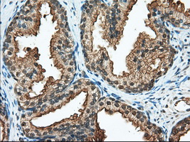 RANGAP1 Antibody - IHC of paraffin-embedded Human prostate tissue using anti-RANGAP1 mouse monoclonal antibody. (Dilution 1:50).