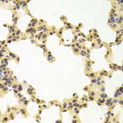 RANGAP1 Antibody - Immunohistochemistry of paraffin-embedded mouse lung tissue.