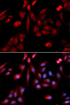RANGAP1 Antibody - Immunofluorescence analysis of U20S cells.