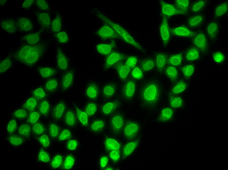 RANGAP1 Antibody - Immunofluorescence analysis of MCF-7 cells.