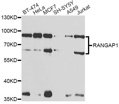 RANGAP1 Antibody - Western blot analysis of extracts of various cell lines, using RANGAP1 antibody at 1:1000 dilution. The secondary antibody used was an HRP Goat Anti-Rabbit IgG (H+L) at 1:10000 dilution. Lysates were loaded 25ug per lane and 3% nonfat dry milk in TBST was used for blocking. An ECL Kit was used for detection and the exposure time was 90s.