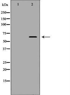 RANGAP1 Antibody - Western blot analysis of 293T whole cells lysates using RANGAP1 antibody. The lane on the left is treated with the antigen-specific peptide.
