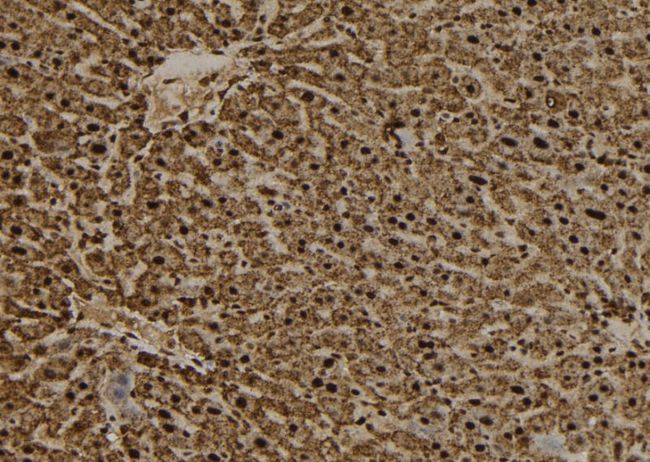 RANGAP1 Antibody - 1:100 staining mouse liver tissue by IHC-P. The sample was formaldehyde fixed and a heat mediated antigen retrieval step in citrate buffer was performed. The sample was then blocked and incubated with the antibody for 1.5 hours at 22°C. An HRP conjugated goat anti-rabbit antibody was used as the secondary.