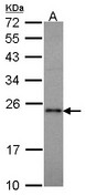 RAP1A Antibody - Sample (30 ug of whole cell lysate). A: Molt-4 . 12% SDS PAGE. RAP1A antibody. RAP1A / RAP1 antibody diluted at 1:1000.