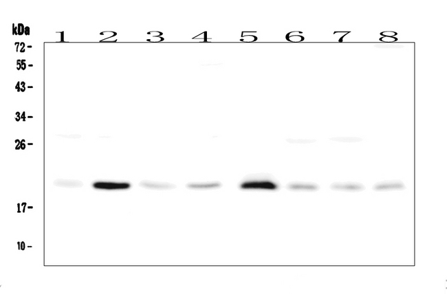 RAP1A Antibody - Western blot analysis of RAP1A using anti-RAP1A antibody. Electrophoresis was performed on a 5-20% SDS-PAGE gel at 70V (Stacking gel) / 90V (Resolving gel) for 2-3 hours. The sample well of each lane was loaded with 50ug of sample under reducing conditions. Lane 1: rat heart tissue lysates, Lane 2: rat lung tissue lysates, Lane 3: rat stomach tissue lysates, Lane 4: rat kidney tissue lysates. Lane 5: mouse heart tissue lysates, Lane 6: mouse lung tissue lysates, Lane 7: mouse stomach tissue lysates, Lane 8: mouse kidney tissue lysates. After Electrophoresis, proteins were transferred to a Nitrocellulose membrane at 150mA for 50-90 minutes. Blocked the membrane with 5% Non-fat Milk/ TBS for 1.5 hour at RT. The membrane was incubated with rabbit anti-RAP1A antigen affinity purified polyclonal antibody at 0.5 µg/mL overnight at 4°C, then washed with TBS-0.1% Tween 3 times with 5 minutes each and probed with a goat anti-rabbit IgG-HRP secondary antibody at a dilution of 1:10000 for 1.5 hour at RT. The signal is developed using an Enhanced Chemiluminescent detection (ECL) kit with Tanon 5200 system. A specific band was detected for RAP1A at approximately 21KD. The expected band size for RAP1A is at 21KD.