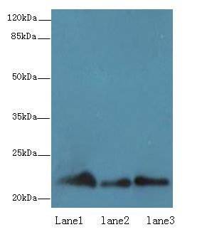 RAP1B Antibody - Western blot. All lanes: RAP1B antibody at 0.7 ug/ml. Lane 1: Mouse brain tissue. Lane 2: A549 whole cell lysate. Lane 3: A431 whole cell lysate. Secondary Goat polyclonal to Rabbit IgG at 1:10000 dilution. Predicted band size: 21 kDa. Observed band size: 21 kDa.