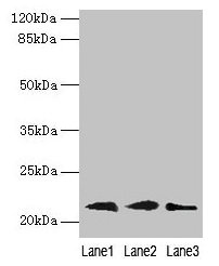 RAP1B Antibody - Western blot All lanes: RAP1B antibody at 0.7µg/ml Lane 1: Mouse brain tissue Lane 2: A549 whole cell lysate Lane 3: A431 whole cell lysate Secondary Goat polyclonal to rabbit IgG at 1/10000 dilution Predicted band size: 21, 16, 19, 17 kDa Observed band size: 21 kDa