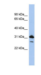 RAP1B Antibody - RAP1B antibody Western blot of PANC1 cell lysate. This image was taken for the unconjugated form of this product. Other forms have not been tested.