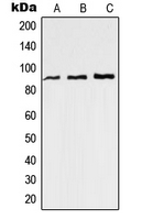 RAP1GAP Antibody - Western blot analysis of RAP1GAP expression in Jurkat (A); HeLa (B); mouse brain (C) whole cell lysates.