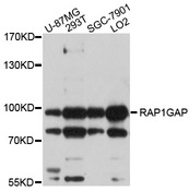 RAP1GAP Antibody - Western blot analysis of extracts of various cell lines, using RAP1GAP antibody at 1:1000 dilution. The secondary antibody used was an HRP Goat Anti-Rabbit IgG (H+L) at 1:10000 dilution. Lysates were loaded 25ug per lane and 3% nonfat dry milk in TBST was used for blocking. An ECL Kit was used for detection and the exposure time was 5s.