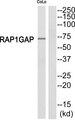 RAP1GAP Antibody - Western blot analysis of extracts from COLO205 cells, using RAP1GDS1 antibody.