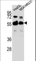 RAP1GDS1 / SmgGDS Antibody - RAP1GDS1 Antibody western blot of HepG2,MDA-MB231 cell line lysates (35 ug/lane). The RAP1GDS1 antibody detected the RAP1GDS1 protein (arrow).