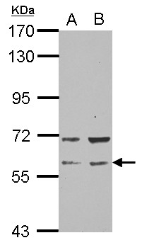 RAP1GDS1 / SmgGDS Antibody - Sample (30 ug of whole cell lysate) A: NT2D1 B: PC-3 7.5% SDS PAGE RAP1GDS1 antibody diluted at 1:1000