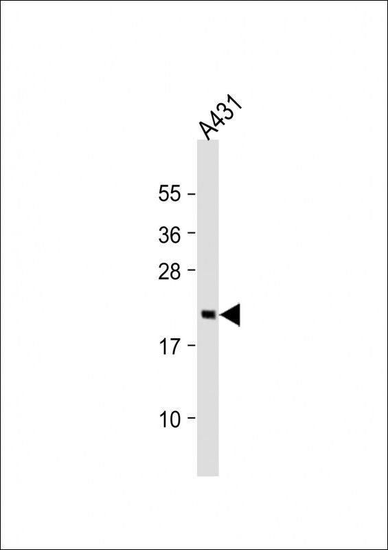 RAP2 Antibody - Anti-RAP2A Antibody (C-Term) at 1:2000 dilution + A431 whole cell lysate Lysates/proteins at 20 ug per lane. Secondary Goat Anti-Rabbit IgG, (H+L), Peroxidase conjugated at 1:10000 dilution. Predicted band size: 21 kDa. Blocking/Dilution buffer: 5% NFDM/TBST.