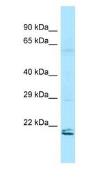 RAP2 Antibody - RAP2 antibody Western Blot of HeLa.  This image was taken for the unconjugated form of this product. Other forms have not been tested.