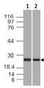 RAP2 Antibody - Fig-1: Western blot analysis of RAP2A. Anti-RAP2A antibody was used at 1 µg/ml on (1) Jurkat and (2) K562 lysates.
