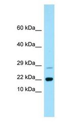 RAP2B Antibody - RAP2B antibody Western Blot of Fetal Liver.  This image was taken for the unconjugated form of this product. Other forms have not been tested.
